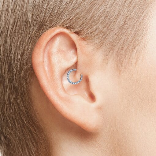 Clicker de titanio con zirconias frontales - Imagen 3
